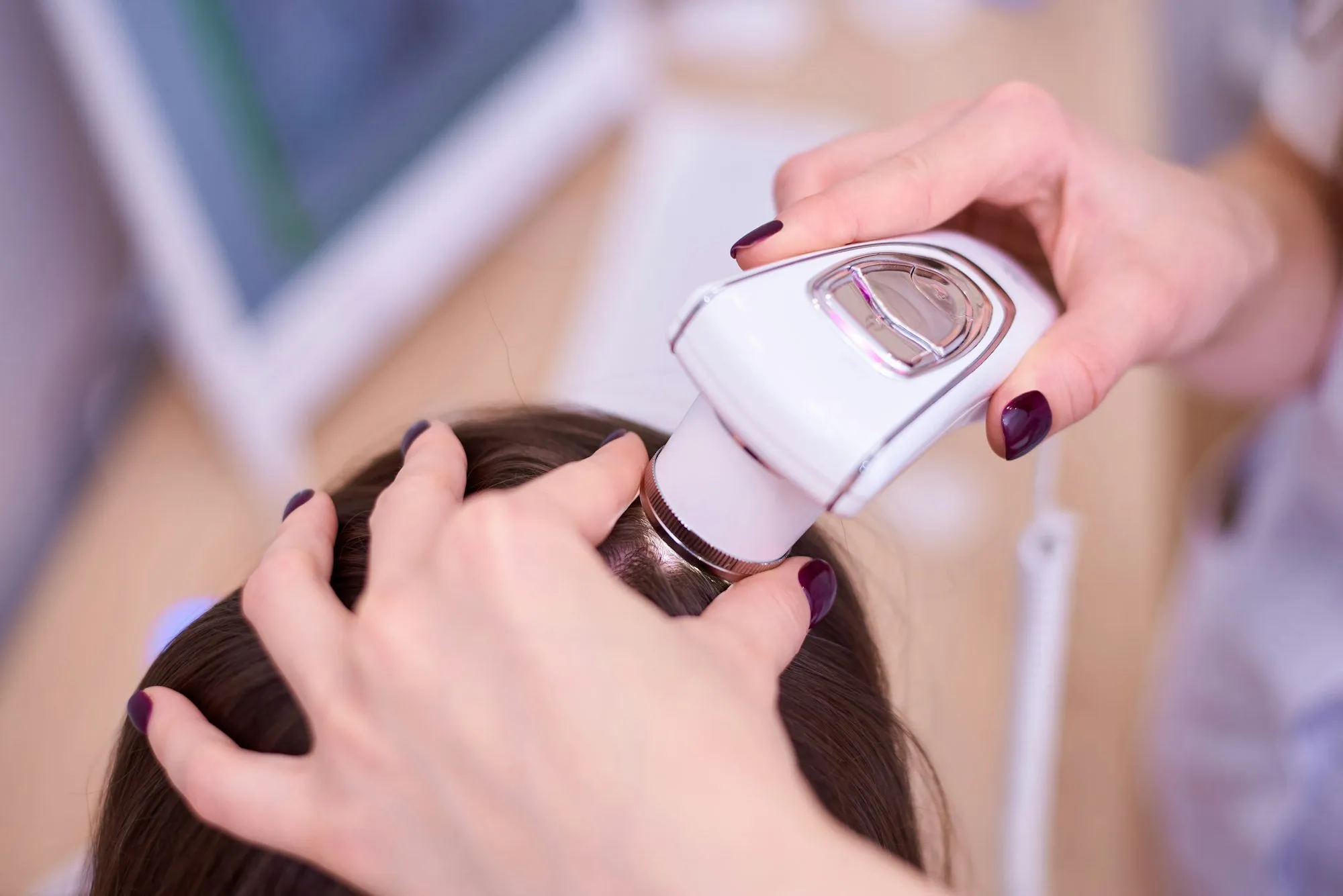 Scalp analysis with a magnified camera